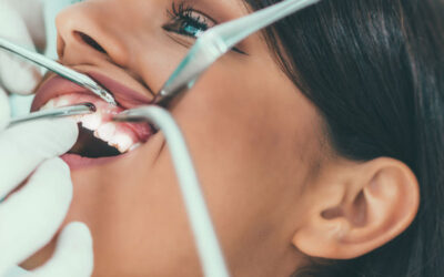 Achieve a Natural Smile with Composite Bonding at Levitas Dental Clinic London