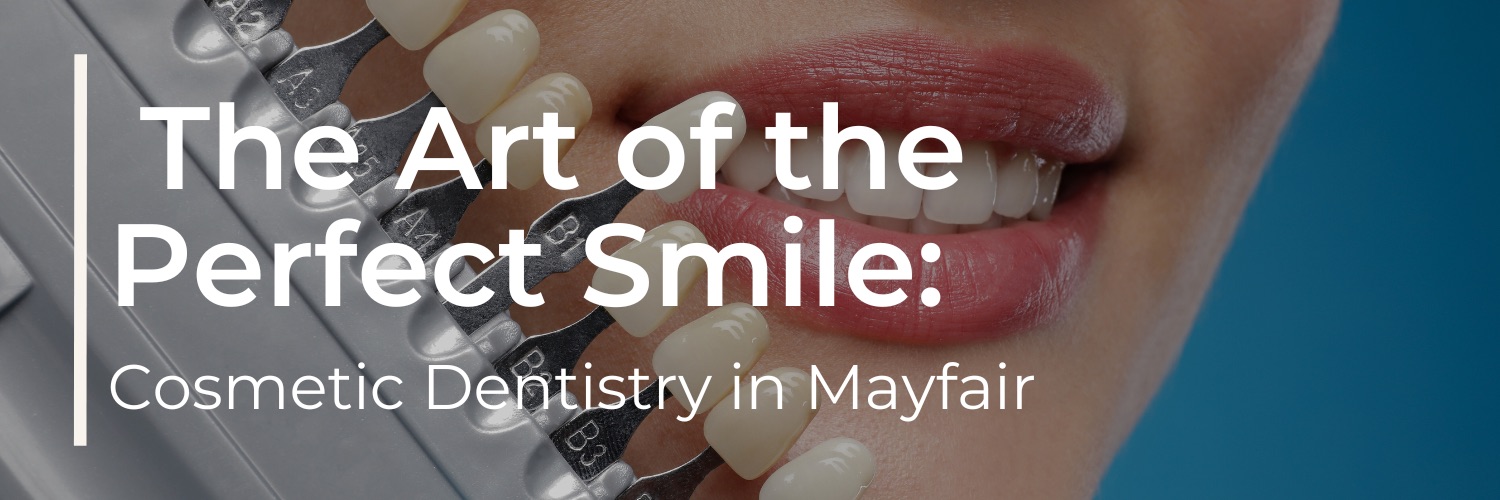 The Art of the Perfect Smile: Cosmetic Dentistry in Mayfair