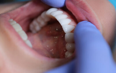 The Transformative Power of Regenerative Dentistry for Long-Term Oral Health