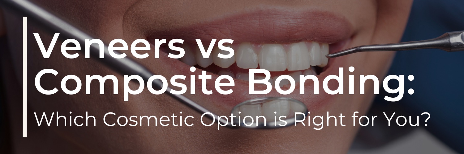 Veneers vs Composite Bonding: Which Cosmetic Option is Right for You?