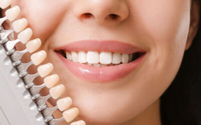 Veneers vs Composite Bonding: Which Cosmetic Option is Right for You?