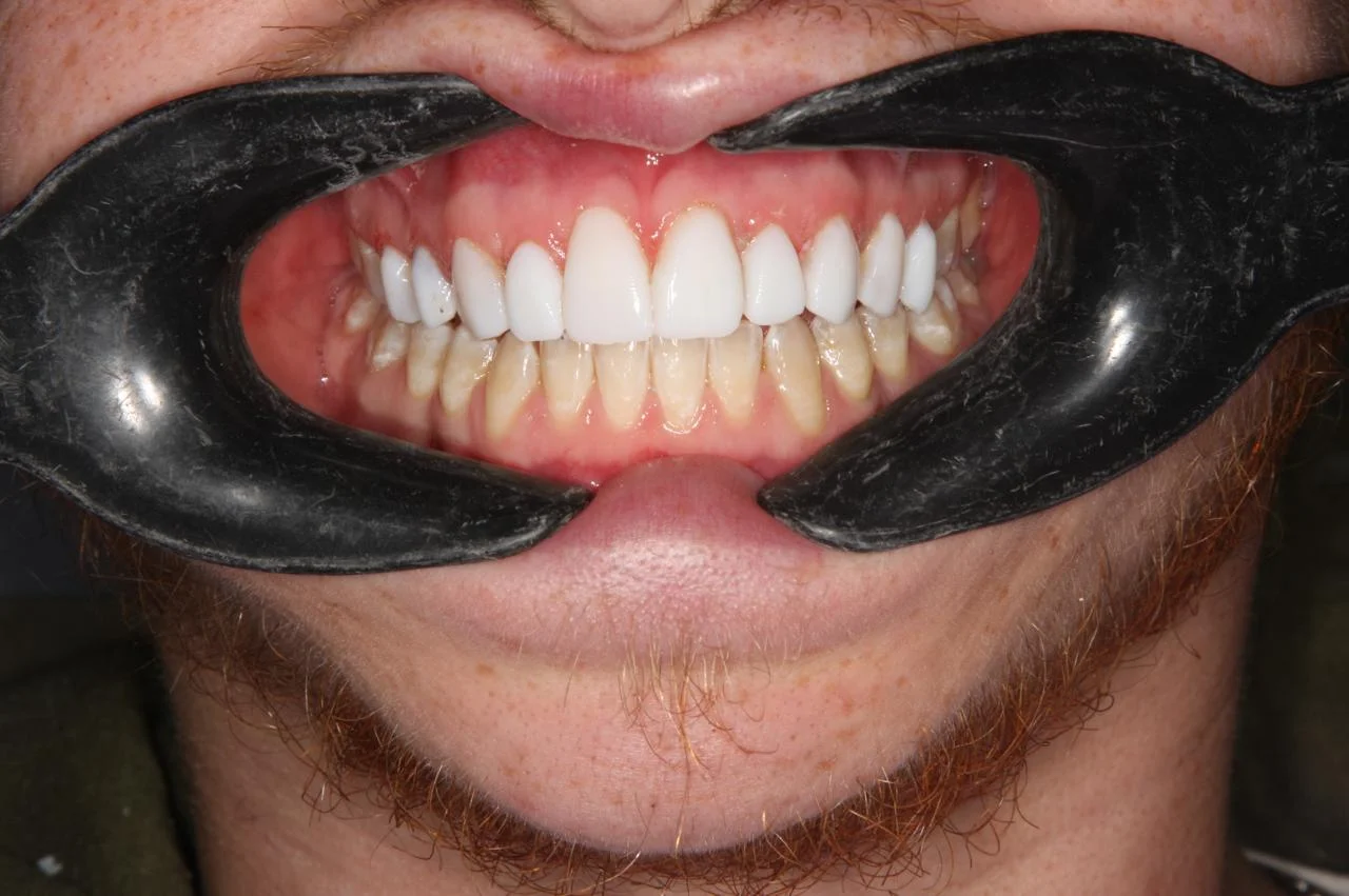 PHOTO-2024-11-21-12-54-38 2 Cosmetic Dentistry Mayfair